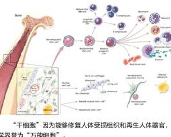 干细胞移植治疗肾病