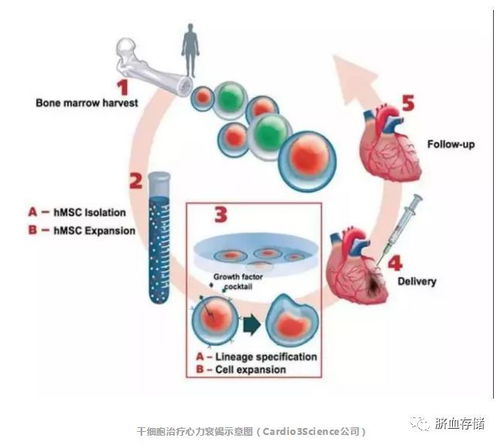干细胞技术新阶段,日本启动全球首例 ips 细胞心脏病临床治疗